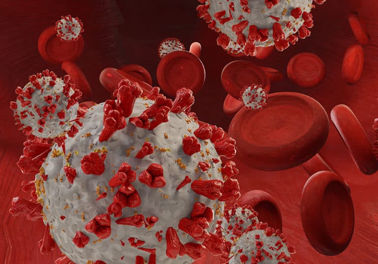 Протичане на ковид – нов определящ фактор? протичане на ковид